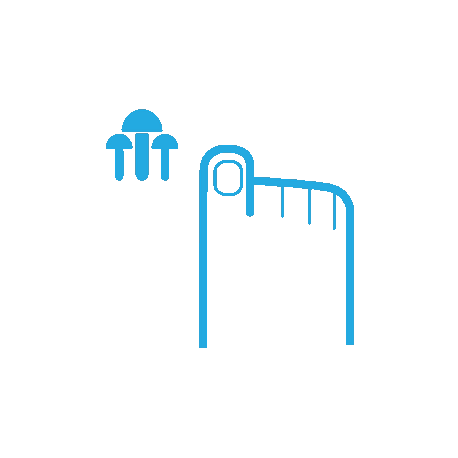 онихомикоз