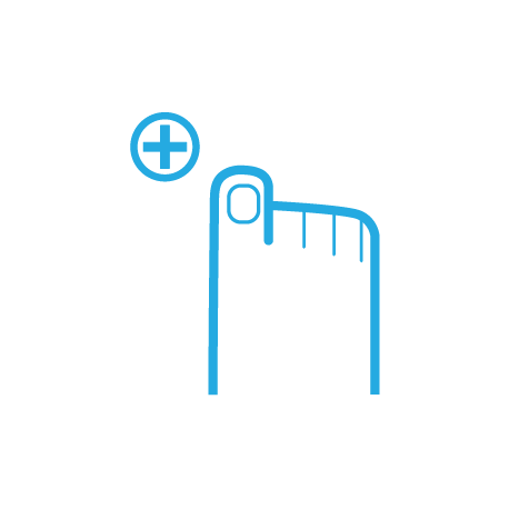 удаление мозолей