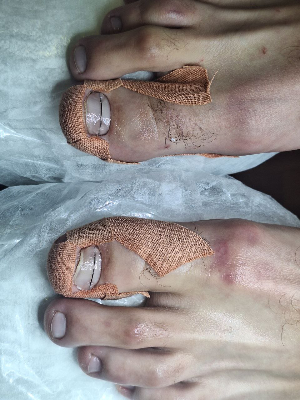 титановая_нить